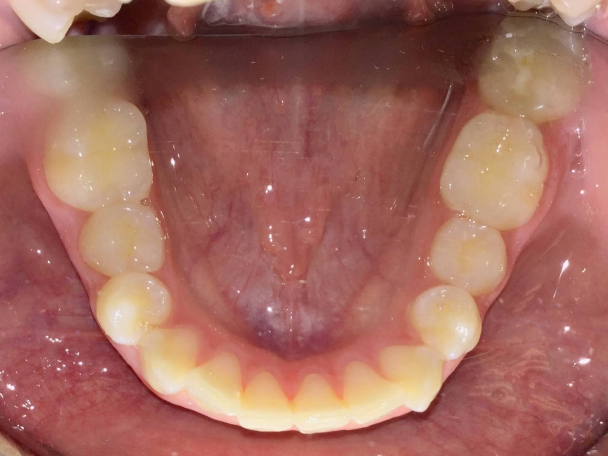 Whetten Orthodontics Virtual Smile